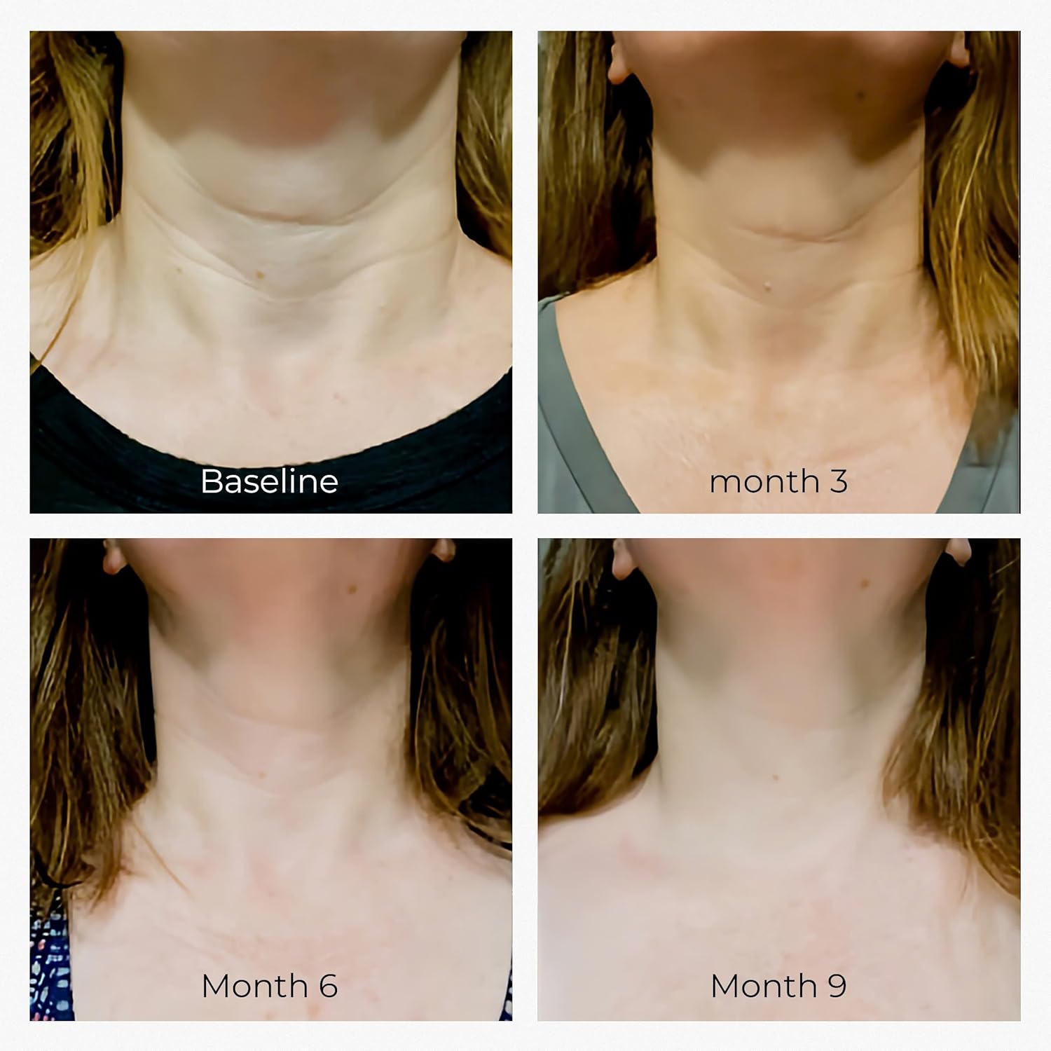OBOGEE Neck Firming Cream (1.8 oz) – Tighten & Lift Sagging Skin image 1